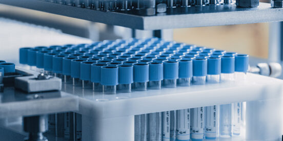 RFID Tracking of Medical Consumables